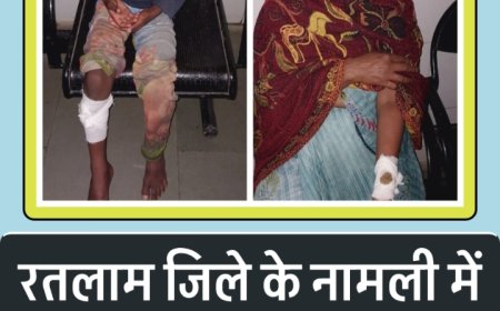 जिले में दहशत : नामली के पास जंगली जानवर का हमला, आधा दर्जन से अधिक लोग घायल, देखें वीडियो