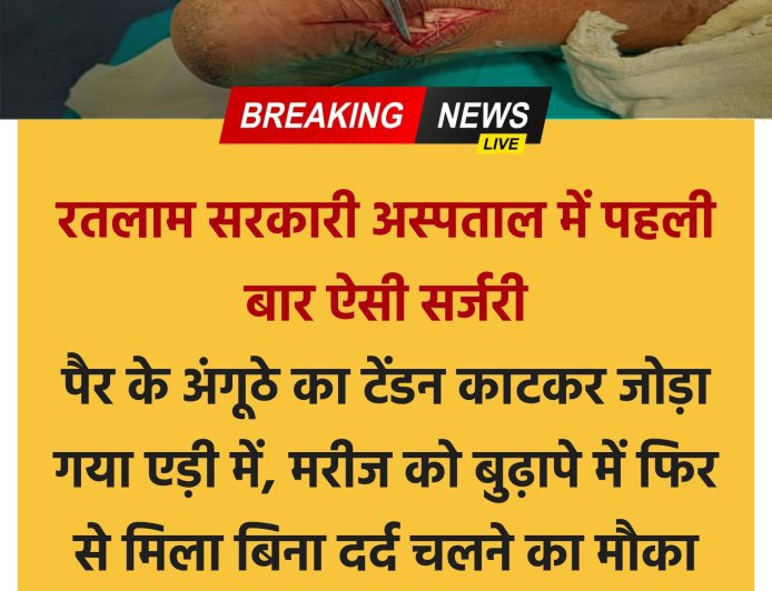 रतलाम के सरकारी अस्पताल में पहली बार हुई ऐसी जटिल सर्जरी  - पैर के अंगूठे से निकाला टेंडन, एड़ी की हड्डी में सुरंग बनाकर जोड़ा